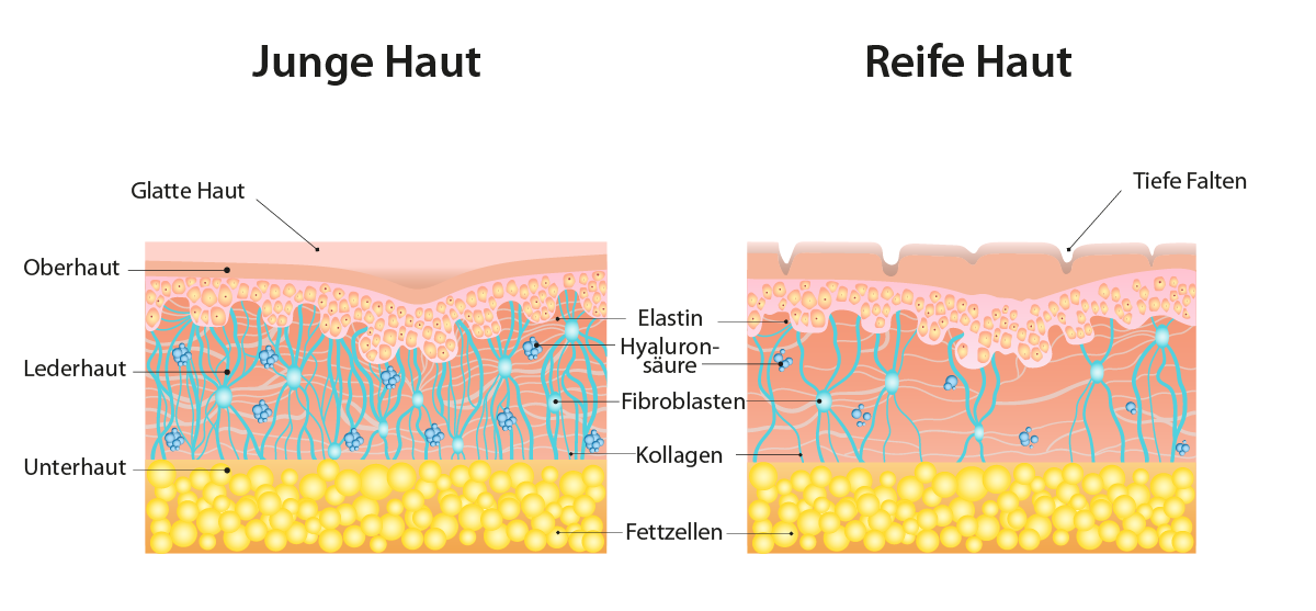 Altersbedingte Ver&auml;nderungen der Haut